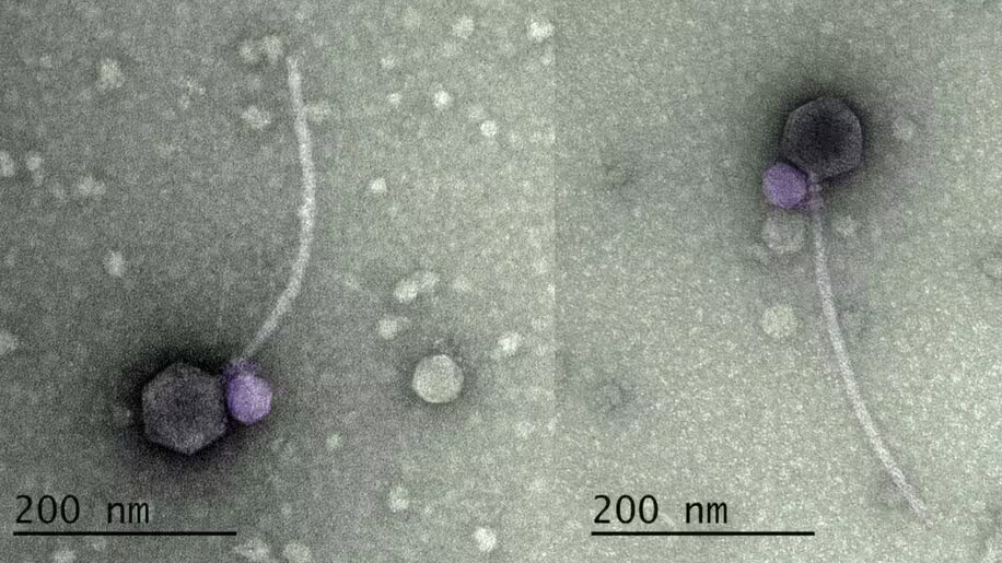 ‘Vampire Viruses’ Discovered For First Time On US Soil | The Independent